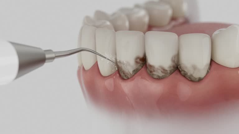 Reliable Dental contractor in Herlong, CA by Smile Center Dentistry